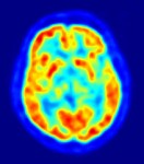 Human Brain